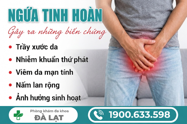 Hình ảnh minh họa